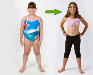Избыточный вес у девочки подростка
